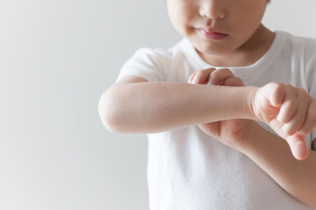 子どもが皮膚を掻いている